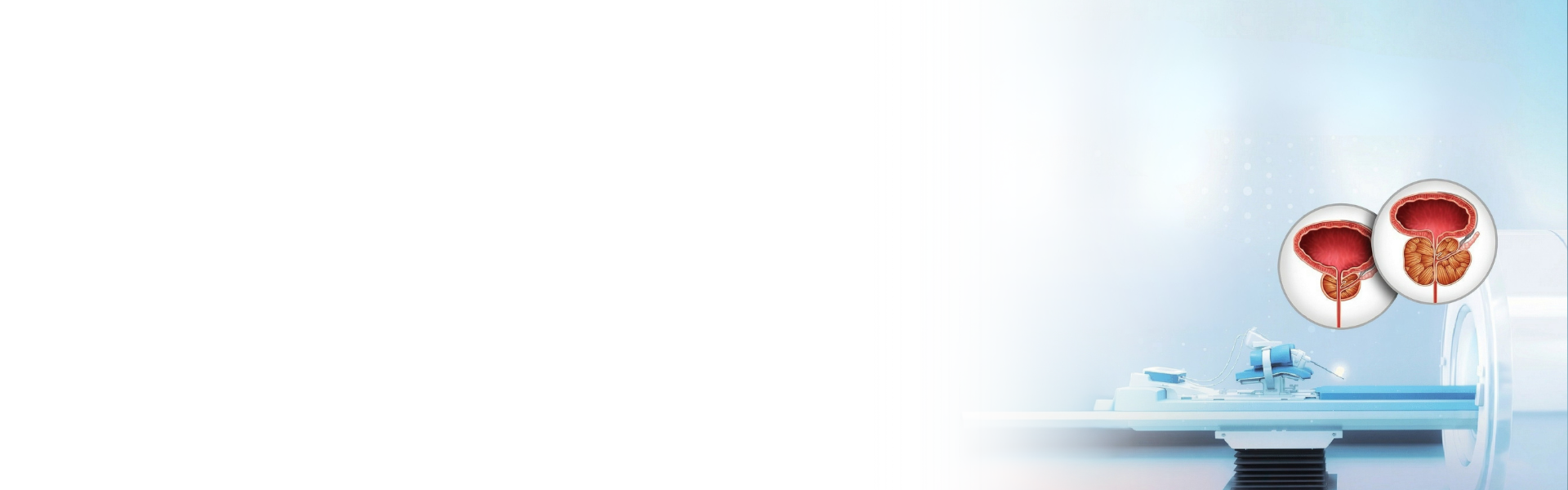 TULSA-PRO — Prostate Treatment Without Surgery